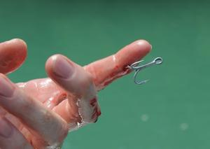 fishing hook in the pointer finger