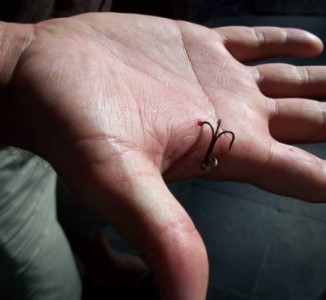 remove a fishing hook from hand