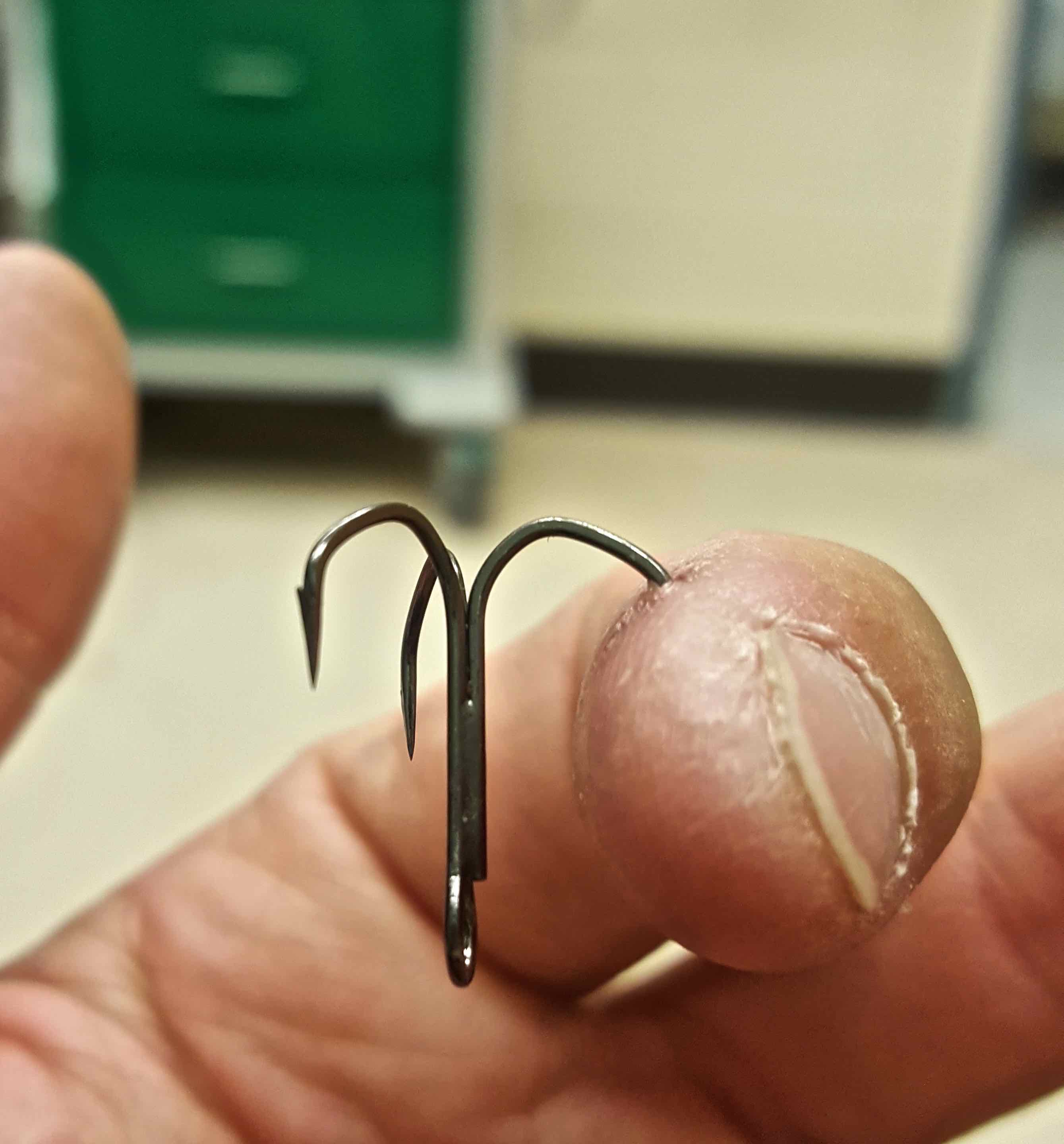 fishing hook stuck in finger