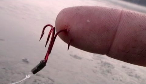 ice fishing hook stuck in finger