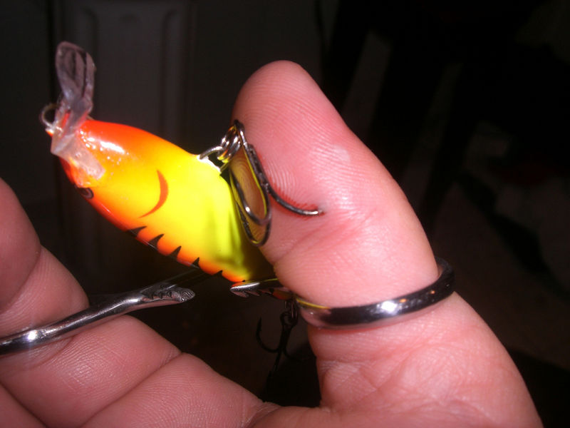 fish hook in thumb