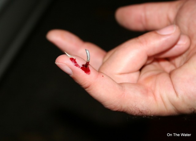 cut-off hook stuck in finger