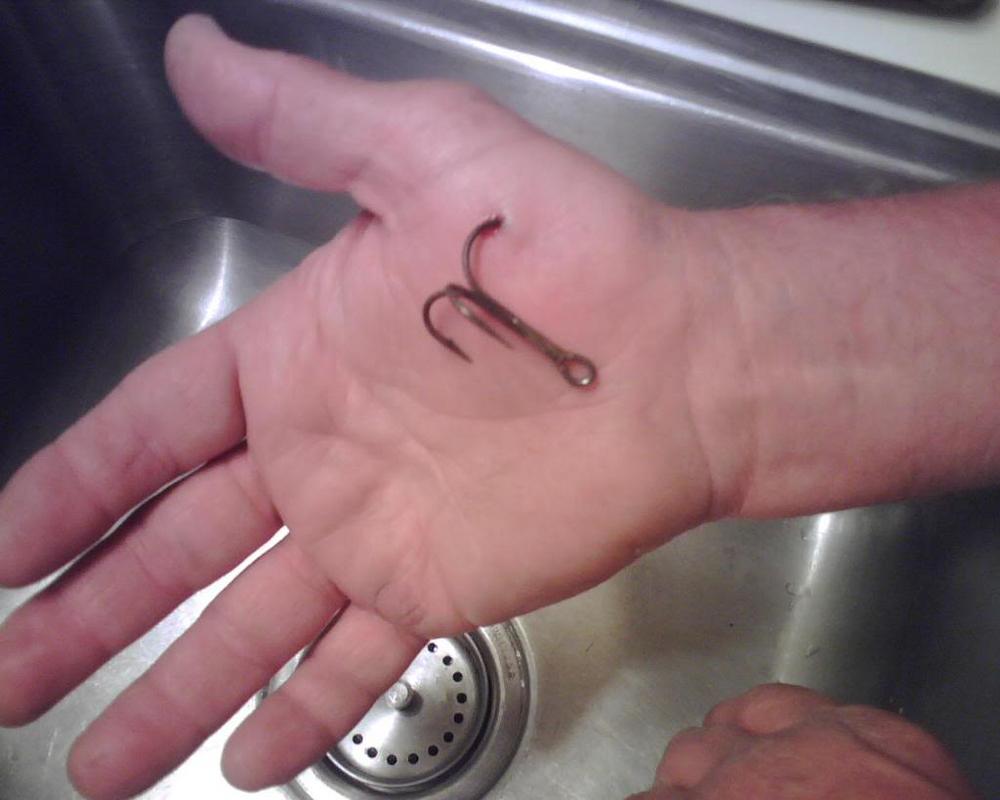 fish hook in hand