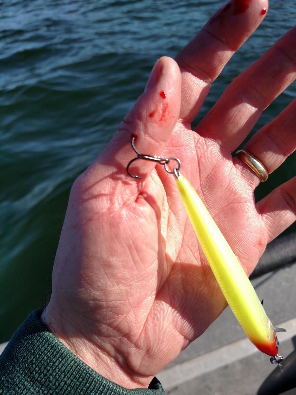 100 Reasons To Replace Your Treble Hooks (Graphic)