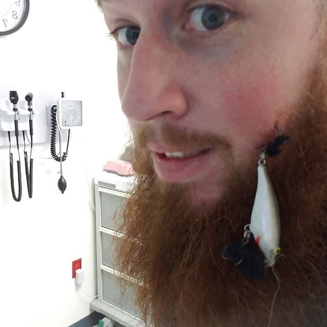 hook stuck in face and beard