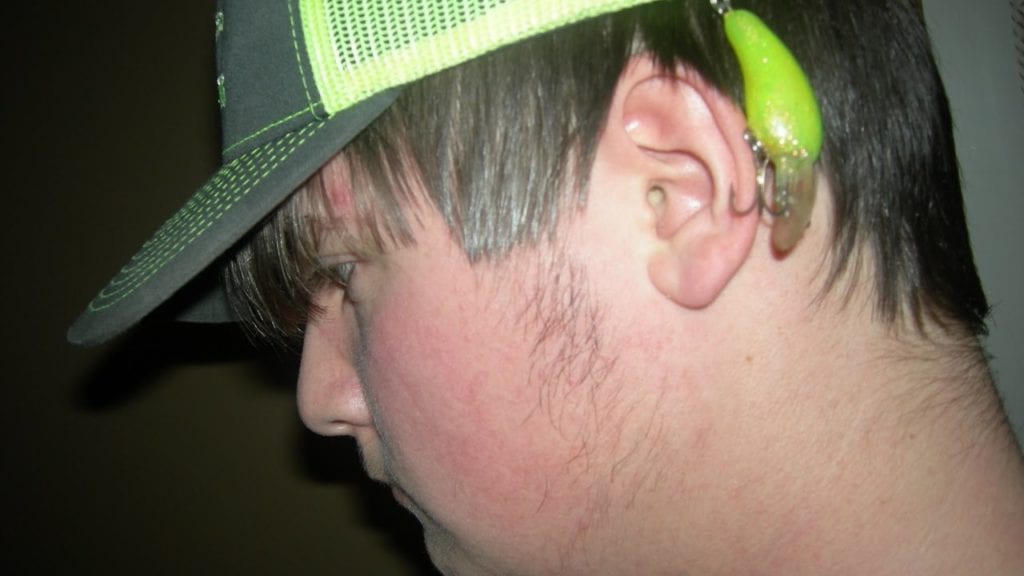 100 Reasons To Replace Your Treble Hooks (Graphic)