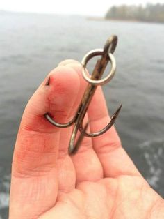 fishing hook in finger