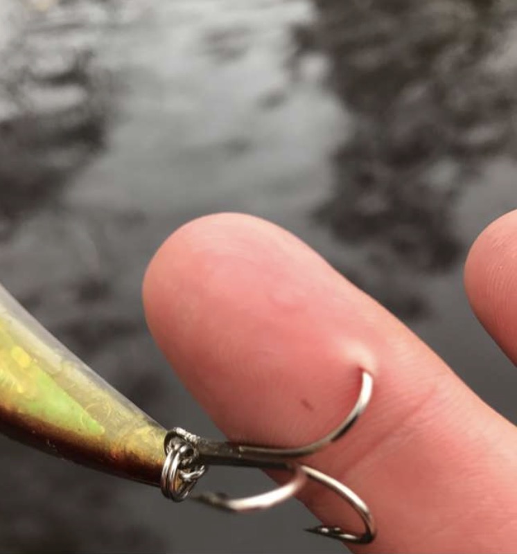 treble hook in the finger
