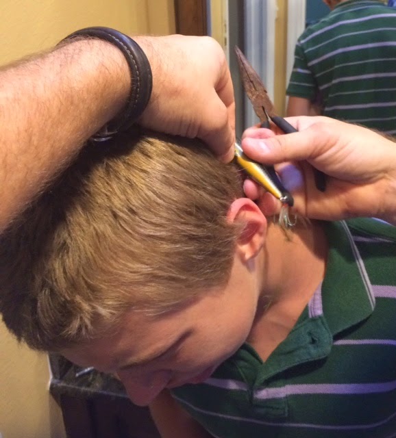 fishing hook in your head