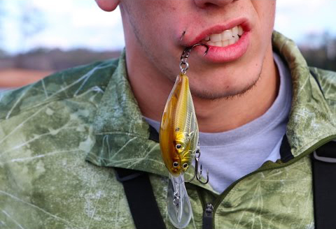 fish hook in the lip