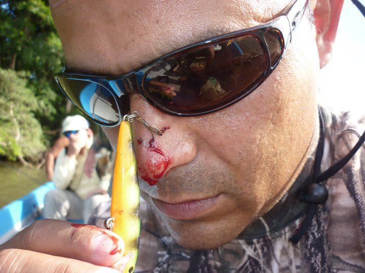 fishing hook in the nose
