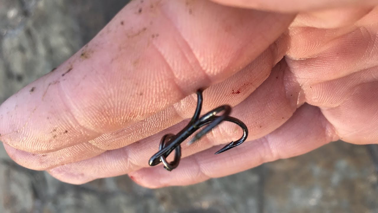 Fishing Hook Stuck in Hand