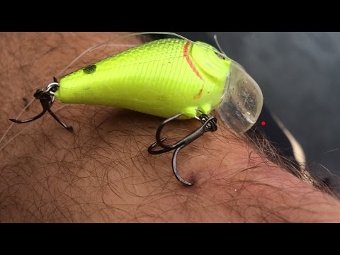 fish hook in the leg